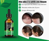 Mooyam – Huile Naturelle Anti-Calvitie & Repousse Rapide des Cheveux