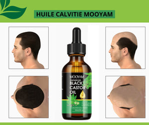 Mooyam – Huile Naturelle Anti-Calvitie & Repousse Rapide des Cheveux