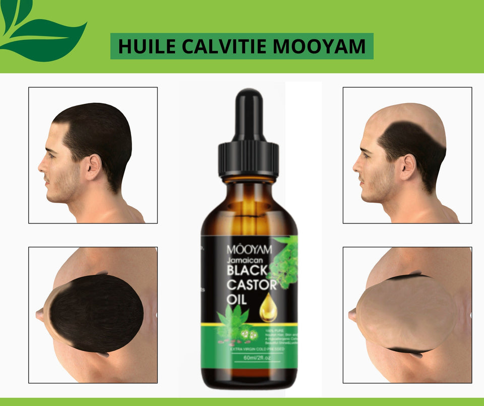 Mooyam – Huile Naturelle Anti-Calvitie & Repousse Rapide des Cheveux
