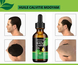 Mooyam – Huile Naturelle Anti-Calvitie & Repousse Rapide des Cheveux